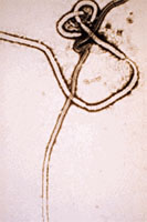 The World Health Organisation confirms that Ebola virus killed thirteen villagers in Gabon.