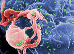Researchers proclaim they found a type of SIVcpz that is almost identical to HIV