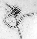 Ebola virus kills 153 people in Zaire
