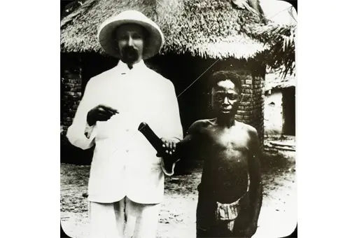 A young victim of the atrocities committed by Belgium in the Congo stands next to a missionary