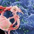 Scanning electron micrograph of HIV-1 budding from cultured lymphocyte