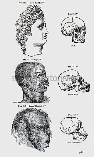Grade 11 - What were the consequences when pseudo-scientific ideas of Race became integral to government policies and legislation in the 19th and 20th centuries?