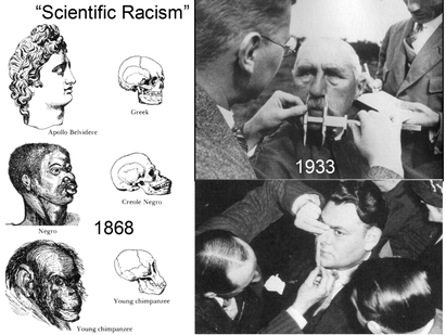 Pseudo-scientific racism and Social Darwinism