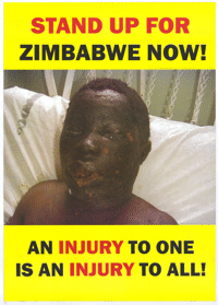 Stand up for Zimbabwe now!