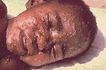 Smallpox Epidemic Strikes at the Cape