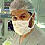 Siamese twins are separated in Cape Town